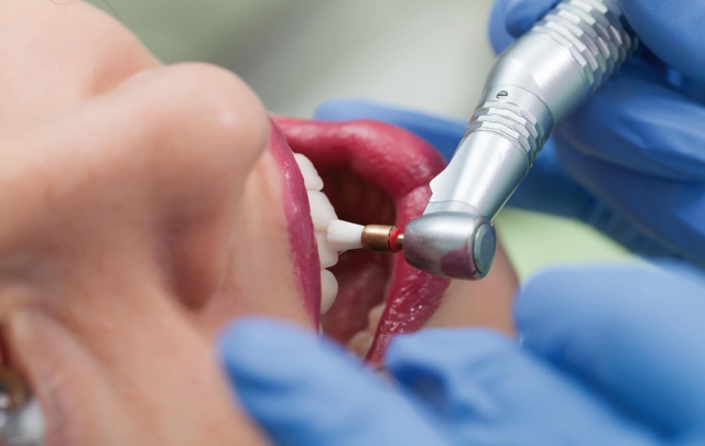 Zahnarzt behandelt die Zähne einer Patientin in Ungarn