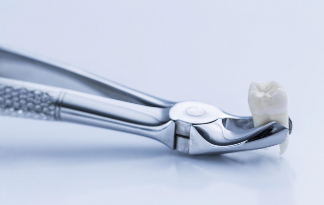 Zahnzange greift einen Zahn an der Zahnwurzel um mit Implantat ersetz zu erden